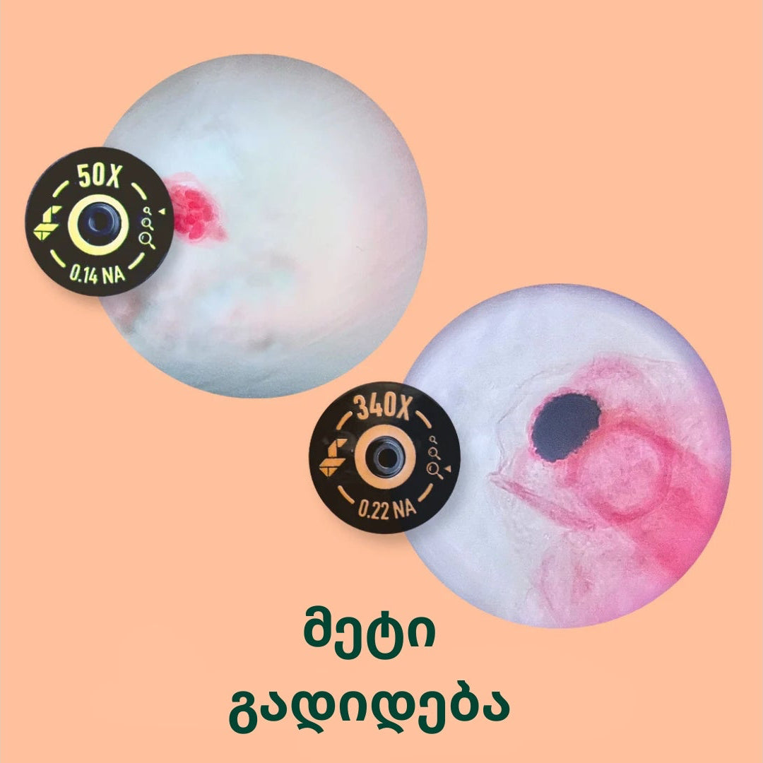 ლინზების ნაკრები